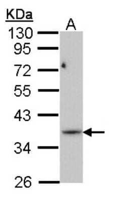 Western Blot: PRPS1L1 Antibody [NBP1-33410] - Sample (30 ug of whole cell lysate) A: Molt-4 10% SDS PAGE; antibody diluted at 1:1000.