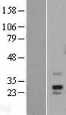 Western Blot: PRPS1L1 Overexpression Lysate (Adult Normal) [NBP2-04437] Left-Empty vector transfected control cell lysate (HEK293 cell lysate); Right -Over-expression Lysate for PRPS1L1.