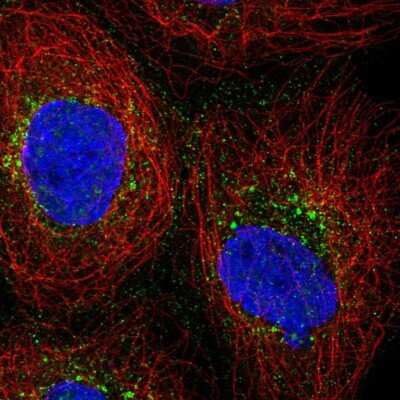 Immunocytochemistry/Immunofluorescence: PRPS2 Antibody [NBP2-56594] - Staining of human cell line A-431 shows localization to vesicles. Antibody staining is shown in green. 