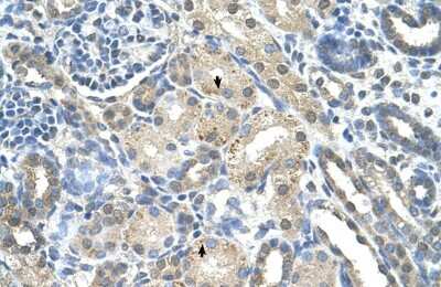 Immunohistochemistry-Paraffin: PRPS2 Antibody [NBP1-57669] - Human kidney Tissue, antibody concentration 4-8ug/ml. Cells with positive label: renal corpuscle cells (indicated with arrows) 400X magnification.