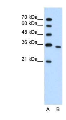 Western Blot: PRPS2 Antibody [NBP1-56666] - Jurkat cell lysate, concentration 1.25ug/ml.