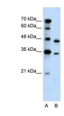 Western Blot: PRPS2 Antibody [NBP1-57669] - Titration: 0.2-1 ug/ml Positive Control: HepG2 cell lysate.