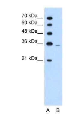 Western Blot: PRPS2 Antibody [NBP1-57670] - Jurkat cell lysate, concentration 1.25ug/ml.