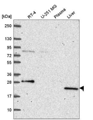 Western Blot: PRPS2 Antibody [NBP2-56594] - Analysis in human cell line RT-4, human cell line U-251 MG, human plasma and human liver tissue.