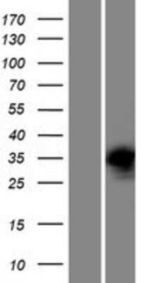 Western Blot: PRPS2 Overexpression Lysate (Adult Normal) [NBP2-08564] Left-Empty vector transfected control cell lysate (HEK293 cell lysate); Right -Over-expression Lysate for PRPS2.