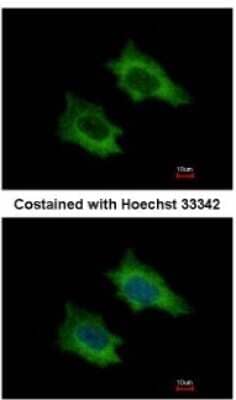 Immunocytochemistry/Immunofluorescence: PRPSAP2 Antibody [NBP1-32630] - Analysis of methanol-fixed HeLa, using antibody at 1:500 dilution.