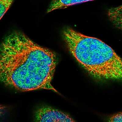 Immunocytochemistry/Immunofluorescence: PRPSAP2 Antibody [NBP1-87341] - Immunofluorescent staining of human cell line U-2 OS shows localization to nucleoplasm & cytosol.