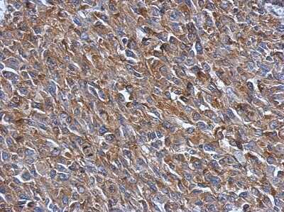 Immunohistochemistry-Paraffin: PRPSAP2 Antibody [NBP2-19966] - Immunohistochemical analysis of paraffin-embedded RT2 xenograft, using antibody at 1:500 dilution.