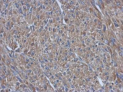 Immunohistochemistry-Paraffin: PRPSAP2 Antibody [NBP2-19966] - Immunohistochemical analysis of paraffin-embedded U87 xenograft, using antibody at 1:500 dilution.