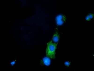 Immunocytochemistry/Immunofluorescence: PRPSAP2 Antibody (OTI1E3) - Azide and BSA Free [NBP2-73676] - Staining of COS7 cells transiently transfected by pCMV6-ENTRY PRPSAP2 .