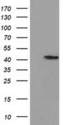 Western Blot: PRPSAP2 Antibody (OTI1E3) - Azide and BSA Free [NBP2-73676] - HEK293T cells were transfected with the pCMV6-ENTRY control (Left lane) or pCMV6-ENTRY PRPSAP2 (Right lane) cDNA for 48 hrs and lysed. Equivalent amounts of cell lysates (5 ug per lane) were separated by SDS-PAGE and immunoblotted with anti-PRPSAP2.