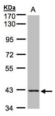 Western Blot PRPSAP2 Antibody