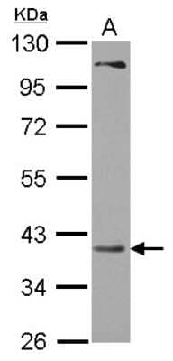 Western Blot: PRPSAP2 Antibody [NBP2-19966] - Sample (30 ug of whole cell lysate) A: K562 10% SDS PAGE gel, diluted at 1:1000.