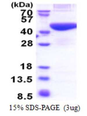 SDS-PAGE Recombinant Human PRPSAP2 His Protein