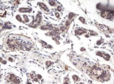 Immunohistochemistry: PRR11 Antibody (OTI2A10) - Azide and BSA Free [NBP2-73677] - Analysis of Human breast tissue.
