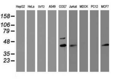 Western Blot: PRR11 Antibody (OTI2A10) - Azide and BSA Free [NBP2-73677] - Analysis of extracts (35ug) from 9 different cell lines by using PRR11 monoclonal antibody (HepG2: human; HeLa: human; SVT2: mouse; A549: human; COS7: monkey; Jurkat: human; MDCK: canine; PC12: rat; MCF7: human).