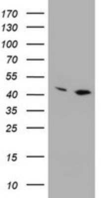 Western Blot: PRR11 Antibody (OTI2A10) - Azide and BSA Free [NBP2-73677] - Analysis of HEK293T cells were transfected with the pCMV6-ENTRY control (Left lane) or pCMV6-ENTRY PRR11.