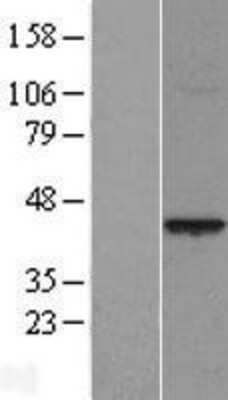 Western Blot PRR11 Overexpression Lysate