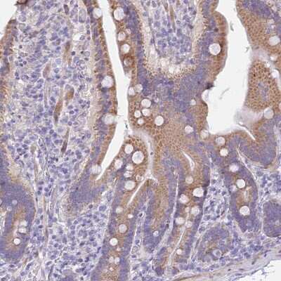 Immunohistochemistry-Paraffin: PRR13 Antibody [NBP1-92299] - Staining of human duodenum shows cytoplasmic positivity in glandular cells.