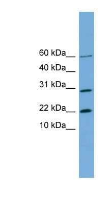 Western Blot: PRR13 Antibody [NBP1-57593] - Hela cell lysate, concentration 0.2-1 ug/ml.