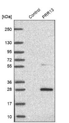 Western Blot: PRR13 Antibody [NBP1-92299] - Analysis in control (vector only transfected HEK293T lysate) and PRR13 over-expression lysate (Co-expressed with a C-terminal myc-DDK tag (3.1 kDa) in mammalian HEK293T cells).