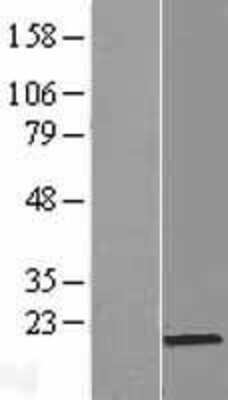 Western Blot: PRR13 Overexpression Lysate (Adult Normal) [NBL1-14832] Left-Empty vector transfected control cell lysate (HEK293 cell lysate); Right -Over-expression Lysate for PRR13.