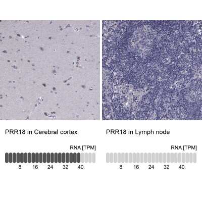 <b>Orthogonal Strategies Validation. </b>Immunohistochemistry-Paraffin: PRR18 Antibody [NBP2-62715] - Analysis in human cerebral cortex and lymph node tissues using Anti-PRR18 antibody. Corresponding PRR18 RNA-seq data are presented for the same tissues.