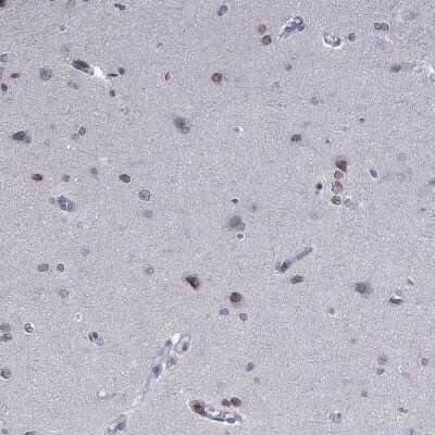 Immunohistochemistry-Paraffin: PRR18 Antibody [NBP2-62715] - Staining of human cerebral cortex shows high expression.