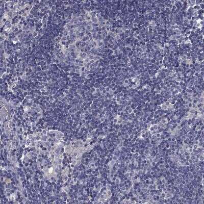Immunohistochemistry-Paraffin: PRR18 Antibody [NBP2-62715] - Staining of human lymph node shows low expression as expected.