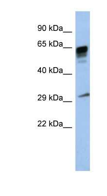 Western Blot: PRR18 Antibody [NBP1-70683] - Titration: 0.2-1 ug/ml, Positive Control: Human Placenta.