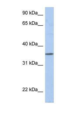Western Blot: PRR18 Antibody [NBP1-70684] - Human Small Intestine, concentration 0.2-1 ug/ml.