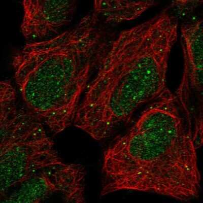 Immunocytochemistry/Immunofluorescence: PRR22 Antibody [NBP2-47320] - Immunofluorescent staining of human cell line HEK 293 shows localization to nucleus & vesicles.
