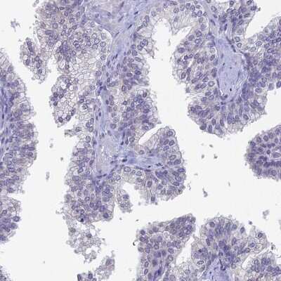 Immunohistochemistry-Paraffin: PRR22 Antibody [NBP2-47320] - Staining of human prostate shows low expression as expected.