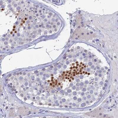 Immunohistochemistry-Paraffin: PRR22 Antibody [NBP2-47320] - Staining of human testis shows high expression.