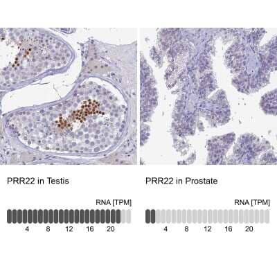 <b>Orthogonal Strategies Validation. </b>Immunohistochemistry-Paraffin: PRR22 Antibody [NBP2-47320] - Staining in human testis and prostate tissues using anti-PRR22 antibody. Corresponding PRR22 RNA-seq data are presented for the same tissues.