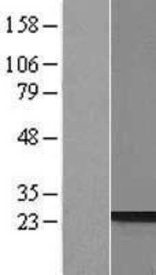 Western Blot: PRR3 Overexpression Lysate (Adult Normal) [NBP2-06222] Left-Empty vector transfected control cell lysate (HEK293 cell lysate); Right -Over-expression Lysate for PRR3.