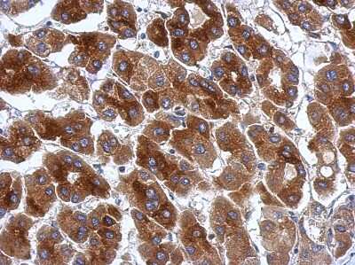 Immunohistochemistry-Paraffin: PRR5 Antibody [NBP2-19968] - Immunohistochemical analysis of paraffin-embedded Hepatoma, using antibody at 1:500 dilution.