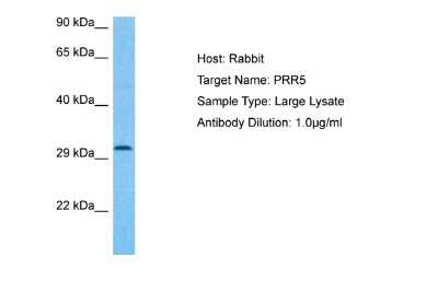 Western Blot: PRR5 Antibody [NBP1-91482] - Host: Rabbit. Target Name: PRR5. Sample Tissue: Large Intestine Tumor lysates. Antibody Dilution: 1.0ug/ml