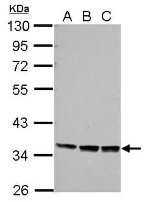 Western Blot: PRR5 Antibody [NBP2-19969] - Sample (30 ug of whole cell lysate) A: Jurkat B: Raji C: K562 10% SDS PAGE gel, diluted at 1:1000.