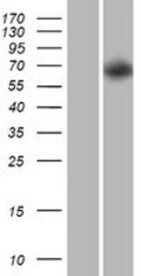 Western Blot: PRR5-ARHGAP8 Overexpression Lysate [NBP2-10236] - Left-Empty vector transfected control cell lysate (HEK293 cell lysate); Right -Over-expression Lysate for PRR5-ARHGAP8.