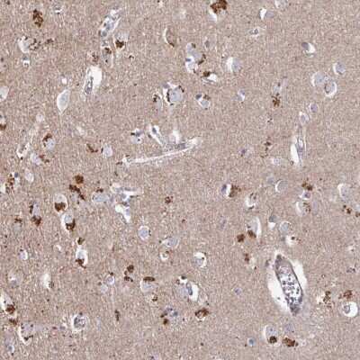Immunohistochemistry: PRR5 Antibody [NBP2-49114] - Staining of human cerebral cortex shows strong cytoplasmic positivity in neuronal cells.