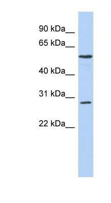 Western Blot: PRRC1 Antibody [NBP1-70687] - Titration: 0.2-1 ug/ml, Positive Control: OVCAR-3 cell lysate.