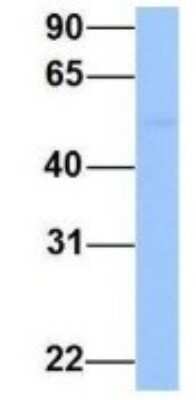 Western Blot: PRRC1 Antibody [NBP1-70687] - Human Fetal Lung, Antibody Dilution: 1.0 ug/ml.