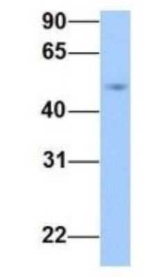 Western Blot: PRRC1 Antibody [NBP1-70687] - Human Jurkat, Antibody Dilution: 1.0 ug/ml PRRC1 is supported by BioGPS gene expression data to be expressed in Jurkat.
