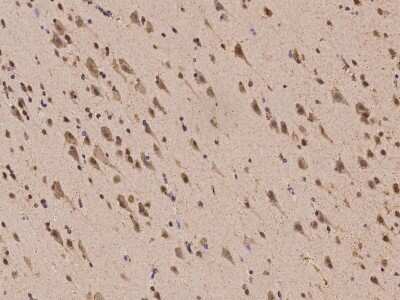 Immunohistochemistry-Paraffin: PRRC2B Antibody [NBP2-98065] - Immunochemical staining of human PRRC2B in human brain with rabbit polyclonal antibody at 1:100 dilution, formalin-fixed paraffin embedded sections.