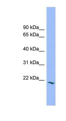 Western Blot: PRRG2 Antibody [NBP1-57017] - Hela cell lysate, concentration 0.2-1 ug/ml.