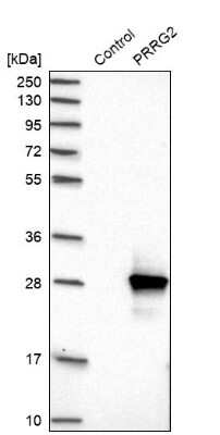 Western Blot PRRG2 Antibody