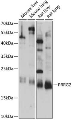 Western Blot: PRRG2 Antibody [NBP2-93368] - Analysis of extracts of various cell lines, using PRRG2 at 1:1000 dilution. Secondary antibody: HRP Goat Anti-Rabbit IgG (H+L) at 1:10000 dilution. Lysates/proteins: 25ug per lane. Blocking buffer: 3% nonfat dry milk in TBST. Detection: ECL Basic Kit . Exposure time: 15s.