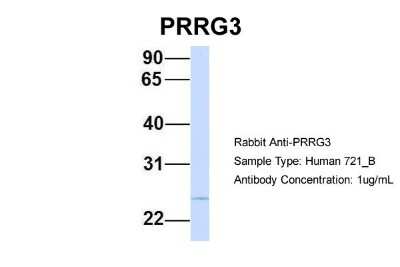 Western Blot PRRG3 Antibody