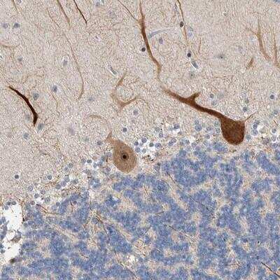 Immunohistochemistry: PRRG4 Antibody [NBP1-80674] - Staining of human cerebellum shows strong nucleolar and cytoplasmic positivity in purkinje cells.